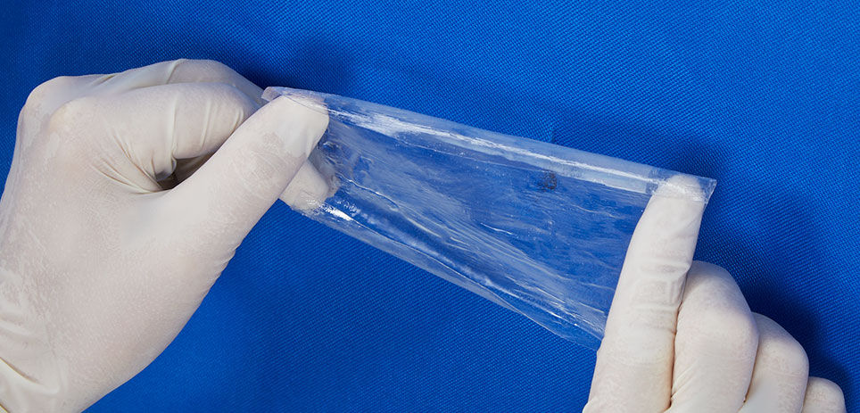 A person wearing protective gloves places a clear vinyl repair patch on a blue pool liner. They are pulling the patch taut with their fingers while placing it firmly on the tear.